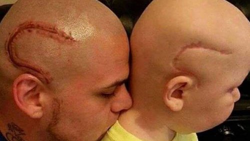 Картинка: Отец сделал тату, чтобы поддержать больного раком сына