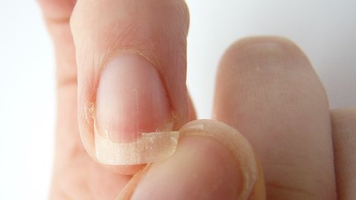Картинка: Проблемы с ногтями? Как привести ногти в порядок за 7 дней! 