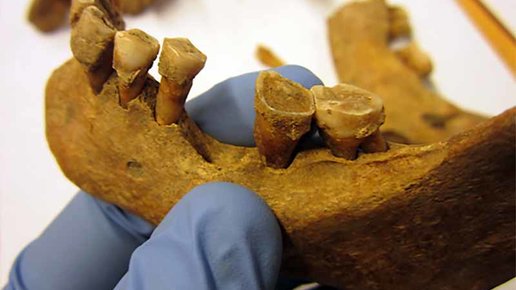 Картинка: Зубы из средневековья помогли изучить эволюцию бактерий, обитающих в нашем рту