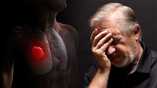 Картинка: Симптомы рака легких: три признака, которые обычно не ассоциируются с болезнью