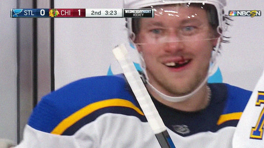 Картинка: Травма и выбитый зуб: россиян покалечили в НХЛ