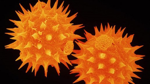 Картинка: 6 удивительных (и не очень) объектов под микроскопом