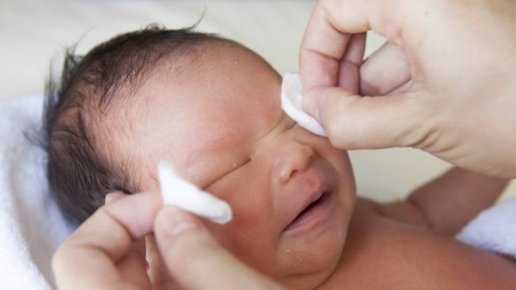 Картинка: Очень полезная статья для мам! Гноятся глазки у новорожденного. Причины.. Как лечить? 
