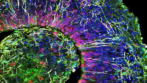 Картинка: Нейронауки в Science и Nature. Выпуск 121: органоиды мозга как модель для понимания генетики аутизма