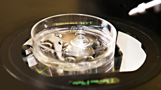 Картинка: Разработан способ отбраковки эмбрионов с низким IQ