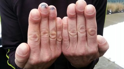 Картинка: Что не так с ногтями Микки Рурка?