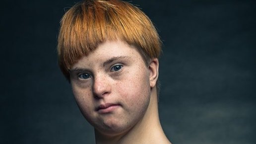 Картинка: В центре внимания новой фотокампании «National Geographic» – люди с синдромом Дауна