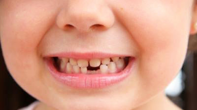 Картинка: Вот почему вы должны спасти молочные зубы вашего ребенка