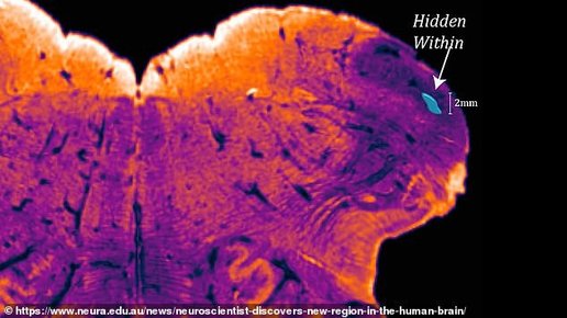 Картинка: Обнаружена неизвестная ранее область мозга, уникальная для людей