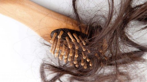 Картинка: «Выпадение волос»: основные причины и методы лечения