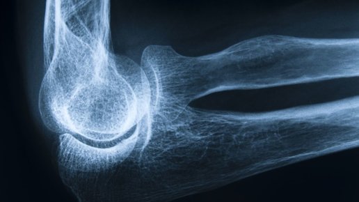 Картинка: Новое исследование свидетельствует, что магний очень важен для костей