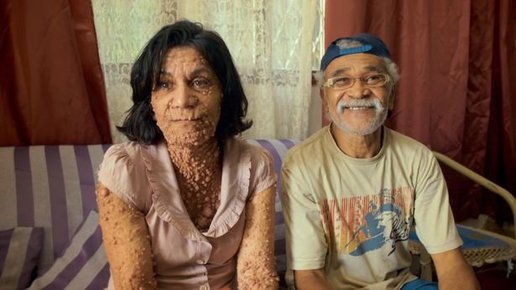 Картинка: Женщина со странной болезнью кожи выглядит как морская пена