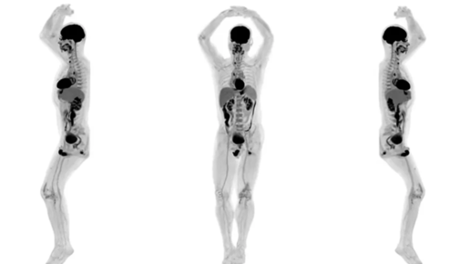Картинка: Создан первый в мире 3D-сканер тела человека