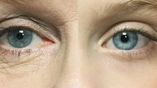 Картинка: Как уплотнить кожу под глазами? Интересные секреты
